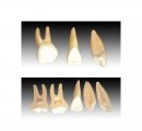 Zväčšenina ľudského zuba