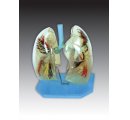 Priesvitný model pľúc